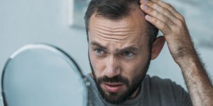 Calvitie : bientot un traitement pour faire pousser les cheveux ?