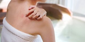 Allergie a l’eau : cette adolescente ne peut plus boire ni se doucher