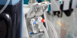 Diabete et insuffisance renale : le traitement par dialyse