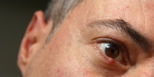 Orgelet interne : comment le soigner ?