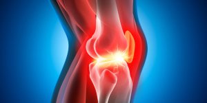 L-arthrose peut-elle etre liee au cancer des os ?