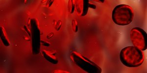 Anemie : faut-il rechercher un cancer de l-estomac ?