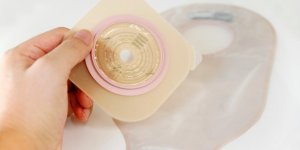 Maladie de Crohn : les rituels d’une patiente stomisee