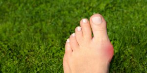 Pieds : comment en finir avec les oignons !