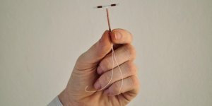 Retrait du sterilet au cuivre : les etapes