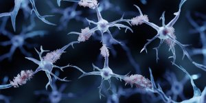 Alzheimer : manger ce fruit protege votre cerveau 