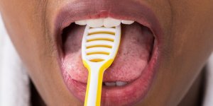 Aphte sur la langue : les causes