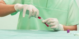 Taux de creatinine elevee : qu-est-ce que ca veut dire ?