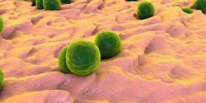 Infection a staphylocoque : est-ce contagieux ?