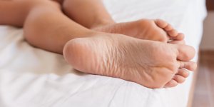 L-homeopathie est-elle efficace contre une verrue plantaire ?