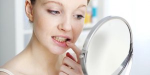 Dents qui se dechaussent : les erreurs a ne plus faire 