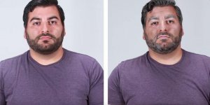 Video. Voici ce que le tabac va faire a votre visage