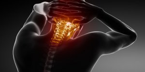Migraine cervicale : qu-est-ce que la cephalee cervicogenique ?