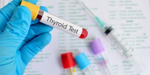 Hypothyroidie d-Hashimoto : une maladie auto-immune