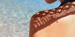 Cortisone et soleil : attention aux effets secondaires