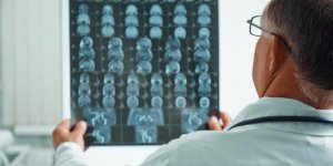 Maladie de Charcot : des traitements naturels ?