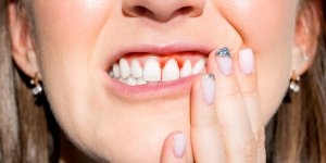 Comment prevenir le dechaussement des dents et les brosser de la bonne facon ? 