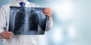 Cancer des os : ce symptome en marchant doit vous alerter