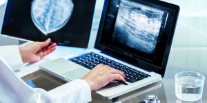 Cancer du sein : le depistage est-il pertinent pour la sante des femmes ?