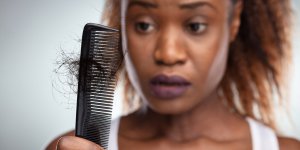 Alopecie (perte de cheveux) : ces coiffures a eviter