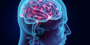 AVC : le risque multiplie par 3 avec des antipsychotiques