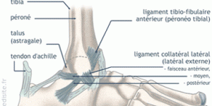 Une blessure frequente : Entorse de la cheville