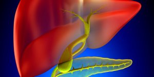 Calculs biliaires : le traitement par cholecystectomie
