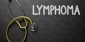 Cancer : les symptomes du lymphome de la rate