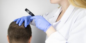 Greffe de cheveux en France : prix, risque... ce qu-il faut savoir