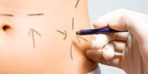 Chirurgie plastique : faut-il se faire operer a l-etranger ?