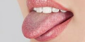 Que revele votre langue de votre sante ?