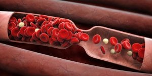 Exces de plomb dans le sang : la cause de cholesterol a laquelle on ne pense pas