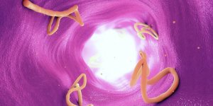 Horreur : un ver solitaire a grandi dans son cerveau pendant 10 ans !