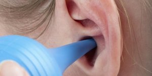 Bouchon de cerumen : une poire auriculaire pour l-enlever