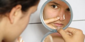 Comment soigner un bouton de stress sur le visage ?