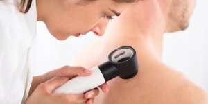 Cancer de la peau : si un de vos proches est atteint, votre risque augmente de 74 %