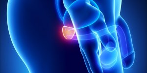 Prostate : Ou faire un depistage ?
