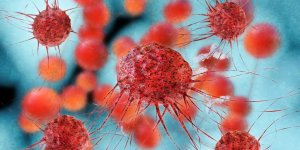 Cancer du sein : les hommes aussi peuvent l-avoir !