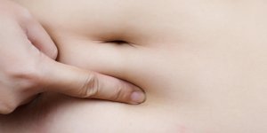 Les causes d-un gros ventre chez la femme qui n-est pas enceinte