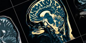 Confinement : comment gerer le quotidien avec une personne atteinte d’Alzheimer ?