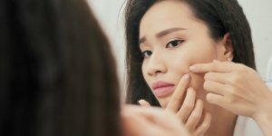 Bouton au visage : 3 cicatrisants naturels