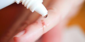 L’antiseptique Hexomedine® ne sera plus rembourse a partir de fevrier 2019