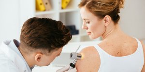 Depistage du cancer de la peau : ces diagnostics express en pharmacie qui inquietent 