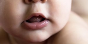 4 remedes contre les aphtes chez le bebe