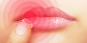 Herpes : l-herpes buccal, c-est quoi ?