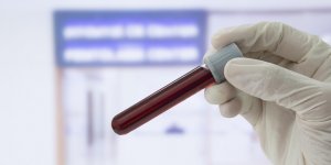 Cholesterol et triglycerides : bien comprendre ses resultats d-analyse