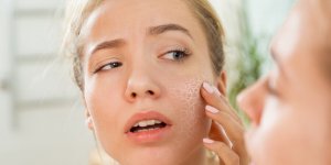 Une dermatologue revele deux types de boisson qui deshydratent votre peau