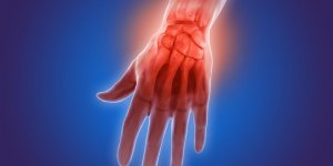 Arthrose des doigts : les nodosites de Bouchard