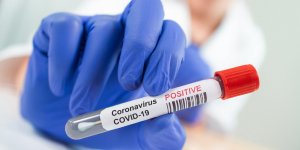 Covid long: pourquoi faut-il imperativement verifier sa vue ?