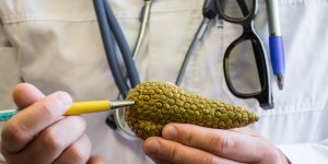 Cancer du pancreas : les signes